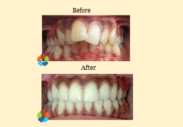 best dental brace clinic in Dhaka, Banani