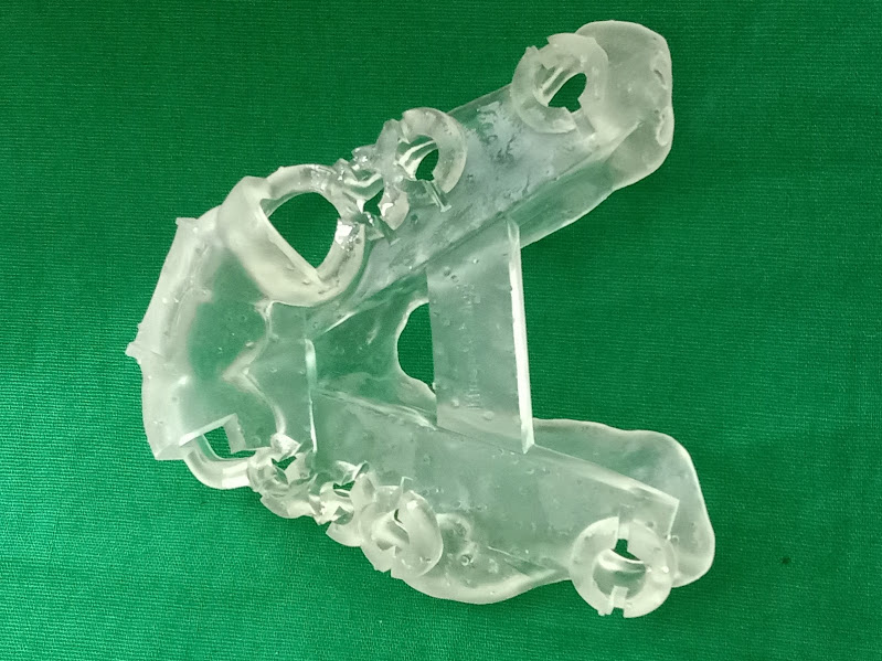 Guided Dental Implant in Dhaka, Banani