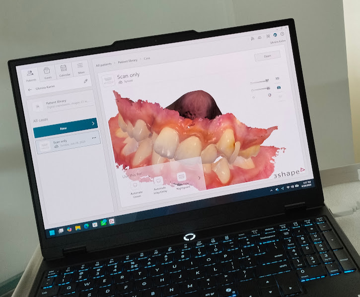 Intraoral Scanner , Dhaka